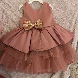 Rose gold